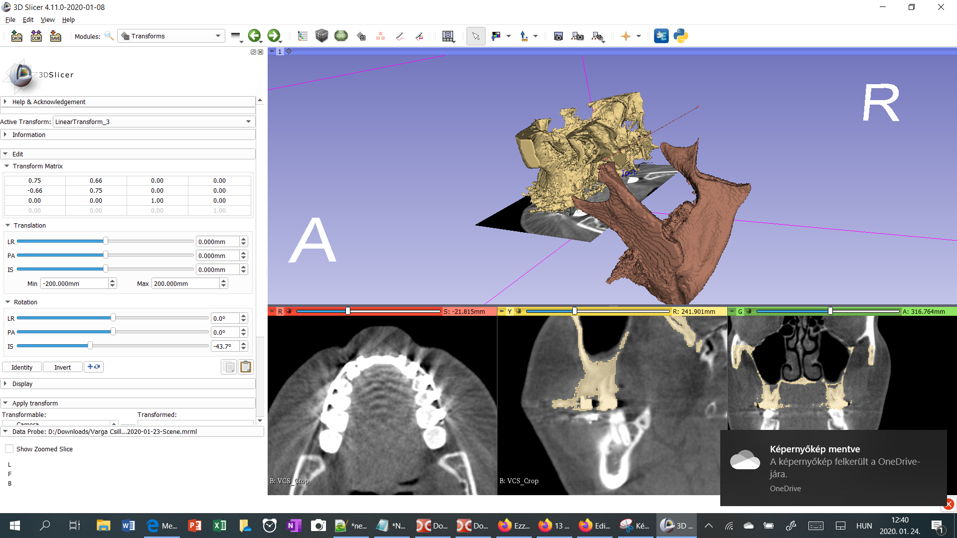 Slicer showing the rotation of a segment around a defined axis, moved with a mouse